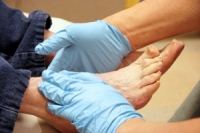 How to Care for Feet Affected by Diabetes